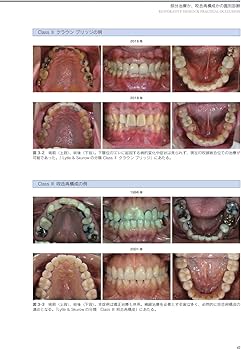 RESTORATIVE DESIGN & PRACTICAL OCCLUSION 補綴設計&設計集 | 本多