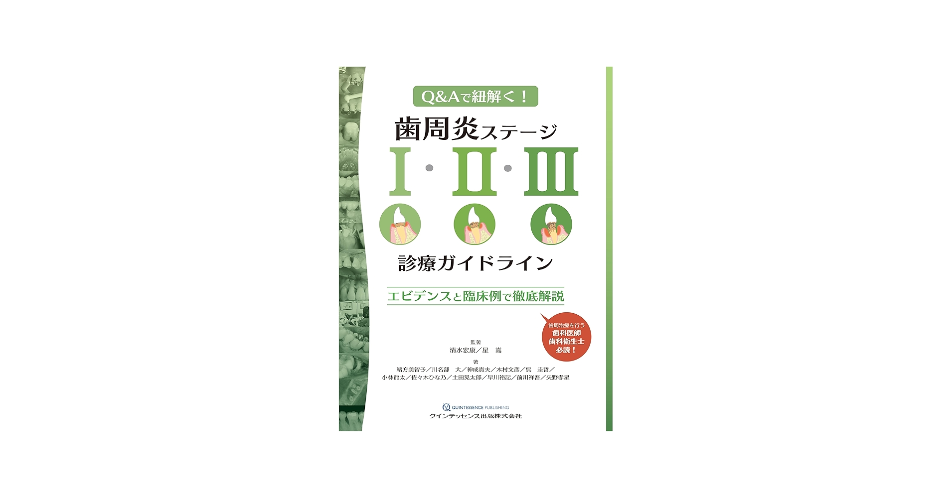 歯周炎ステージI・II・III診療ガイドライン: エビデンスと臨床例で徹底