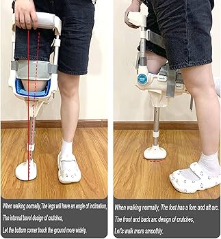 Amazon.co.jp: ハンズフリー松葉杖、痛みのない膝松葉杖、松葉杖の代替
