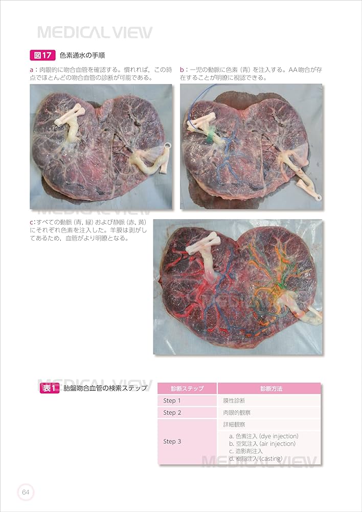 多胎妊娠−妊娠・分娩・新生児管理のすべて−改訂第2版 | 村越 毅 |本