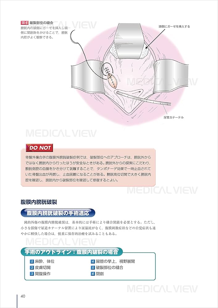 外傷の手術と救急処置 (Urologic Surgery Next 9) | 山本 新吾, 兼松