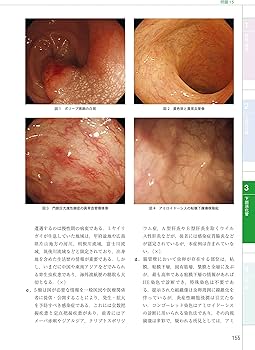日本消化器内視鏡学会専門医学術試験問題 解答と解説 第5版 | 一般社団