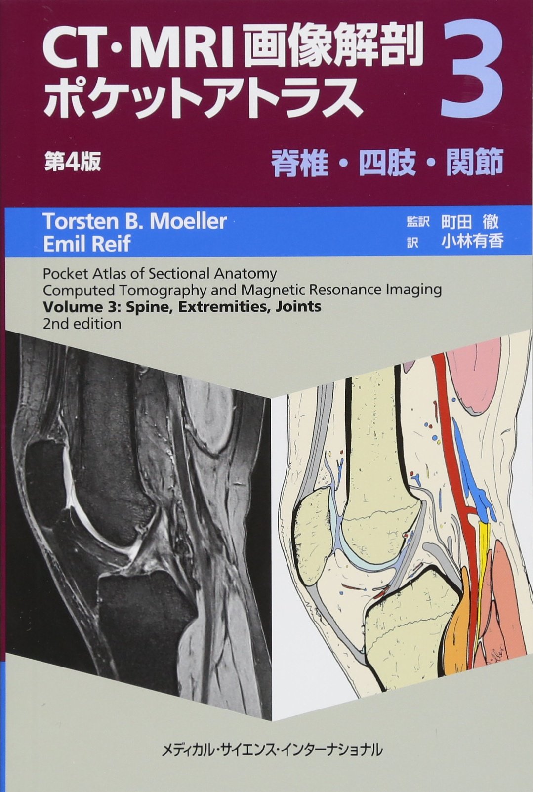 CT・MRI画像解剖ポケットアトラス 第4版 第3巻 脊椎・四肢・関節