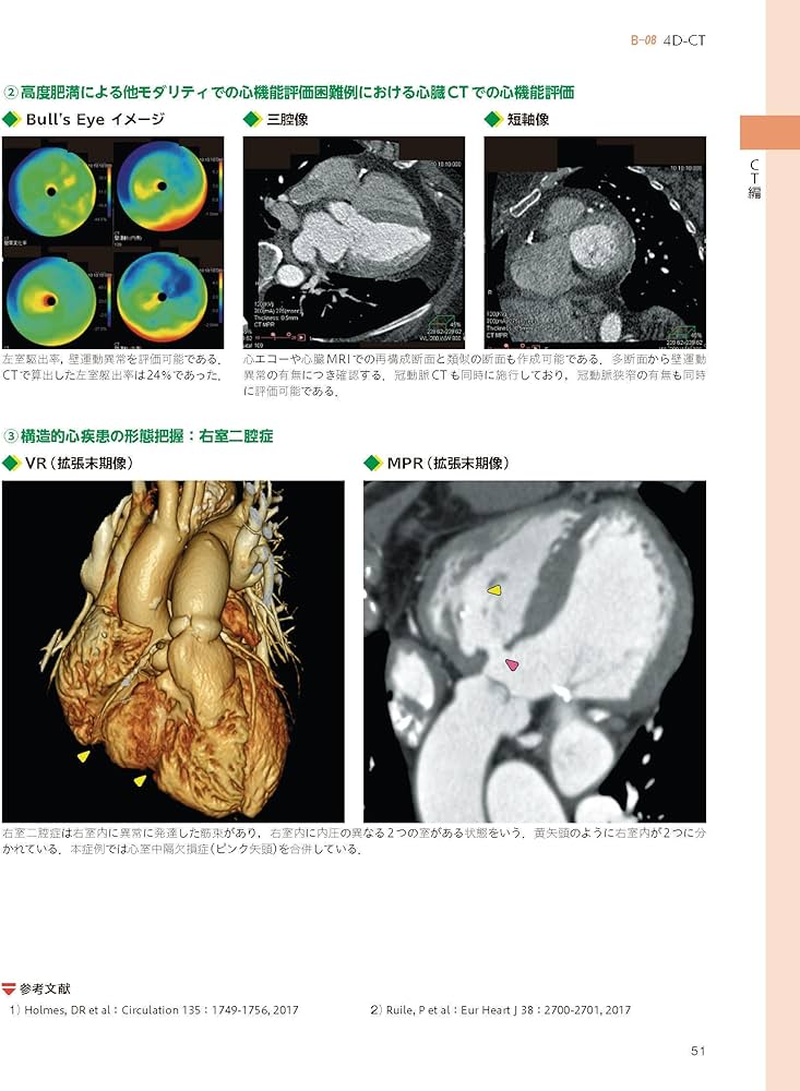 心臓血管CT・MRI図鑑 | 加地 修一郎 |本 | 通販 | Amazon