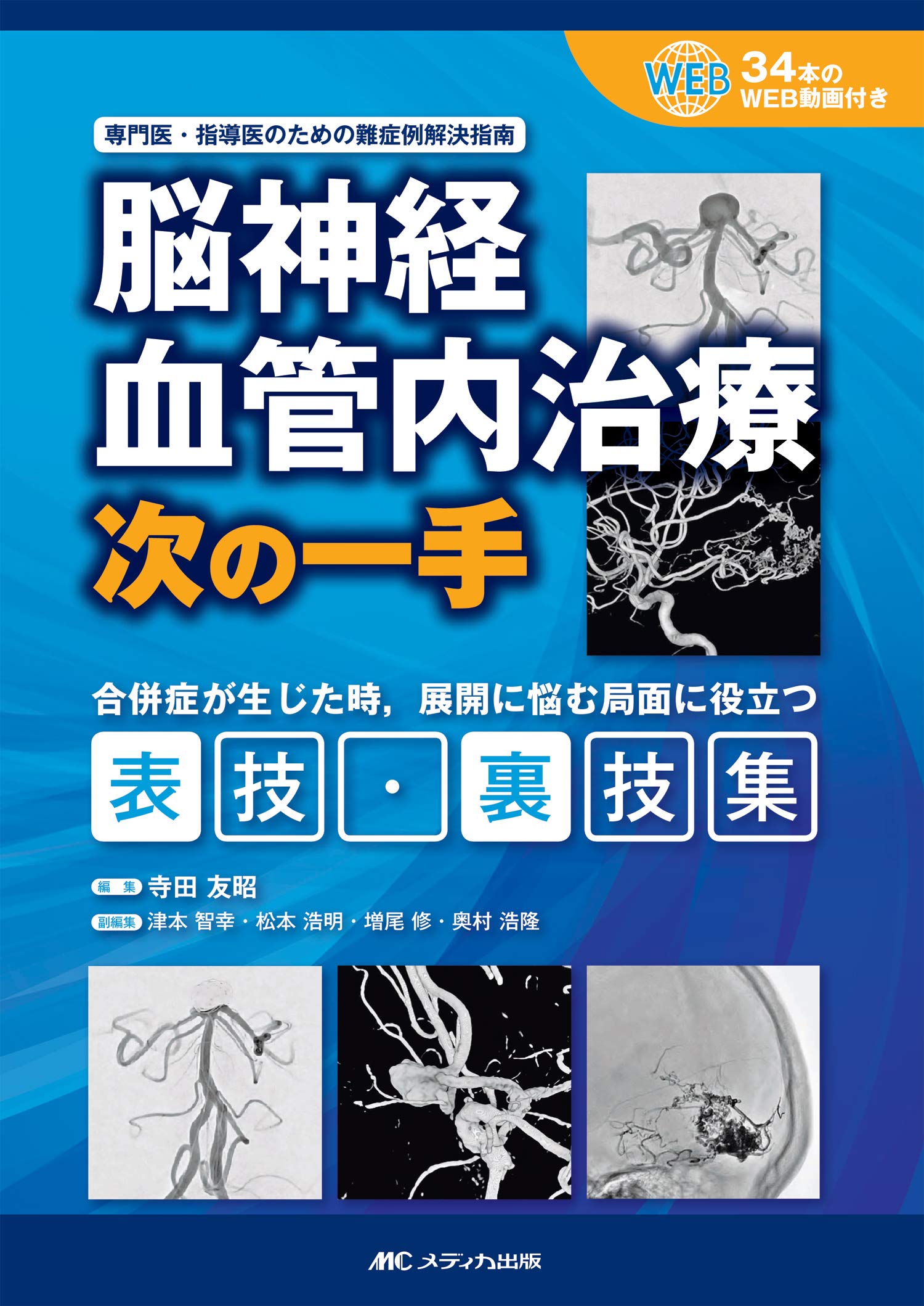 脳神経血管内治療 次の一手: 専門医・指導医のための難症例解決指南