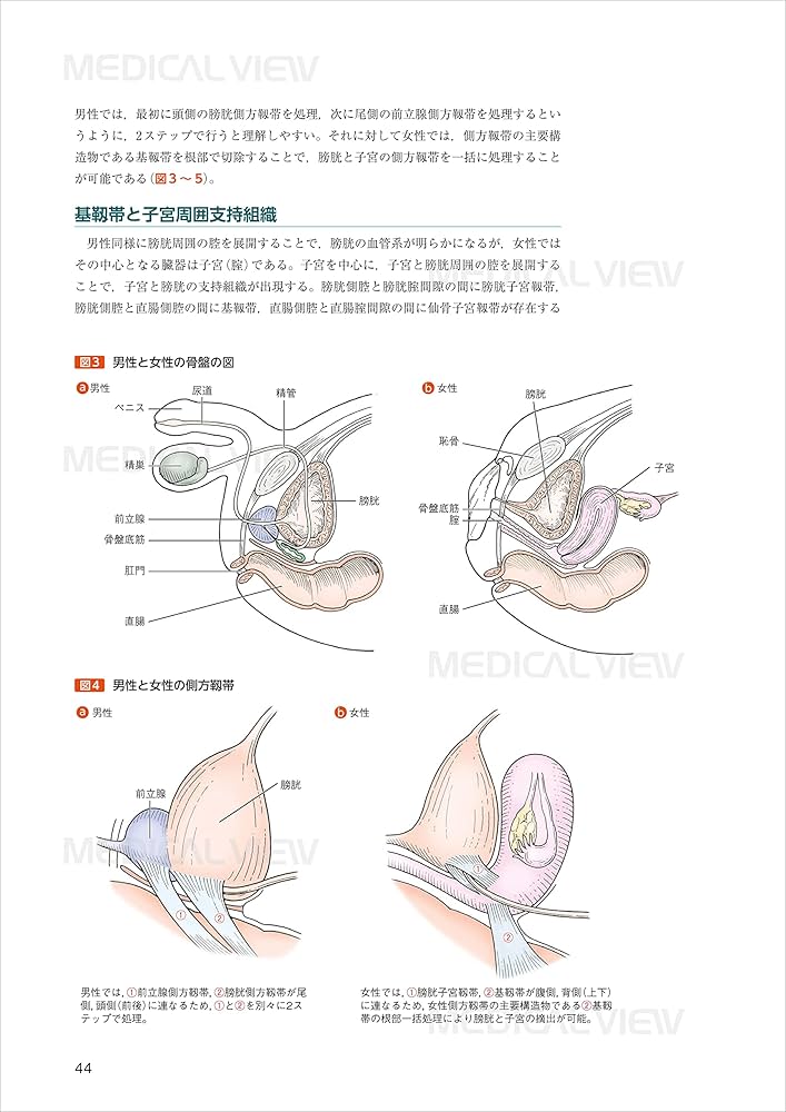 究める鏡視下膀胱全摘術・尿路変向術 Level up LRC, RARC | 三木 淳