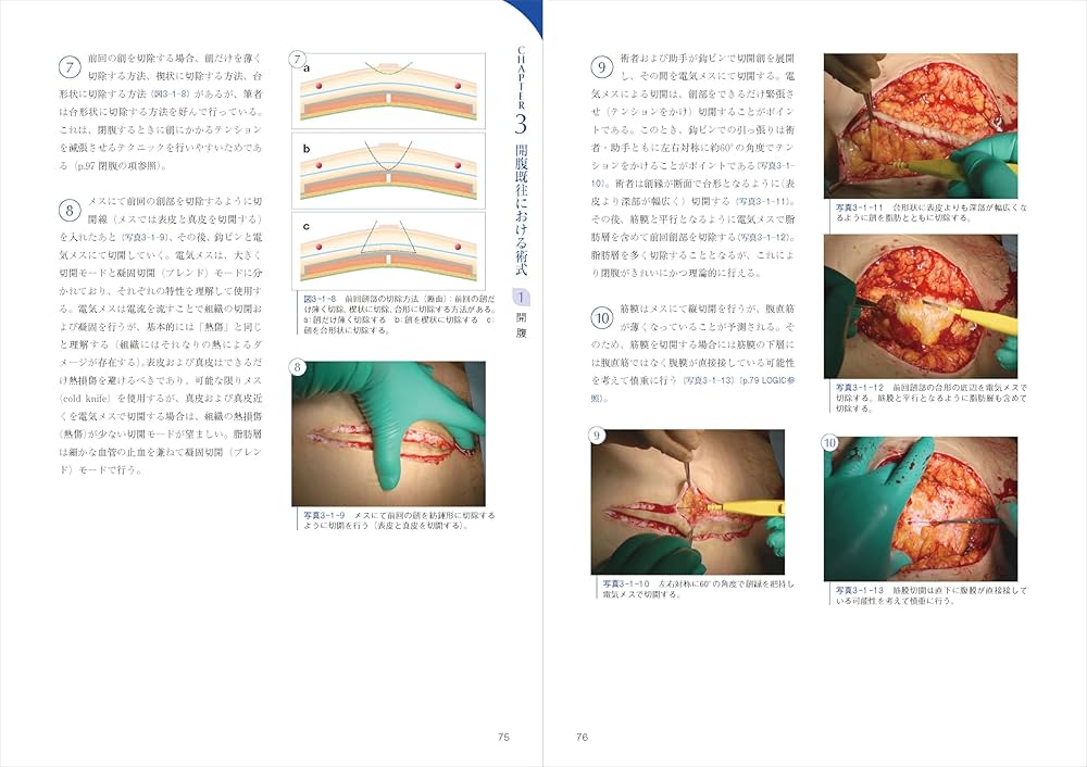 エキスパートこだわりの帝王切開術：理論＋根拠を押さえてコツを得る