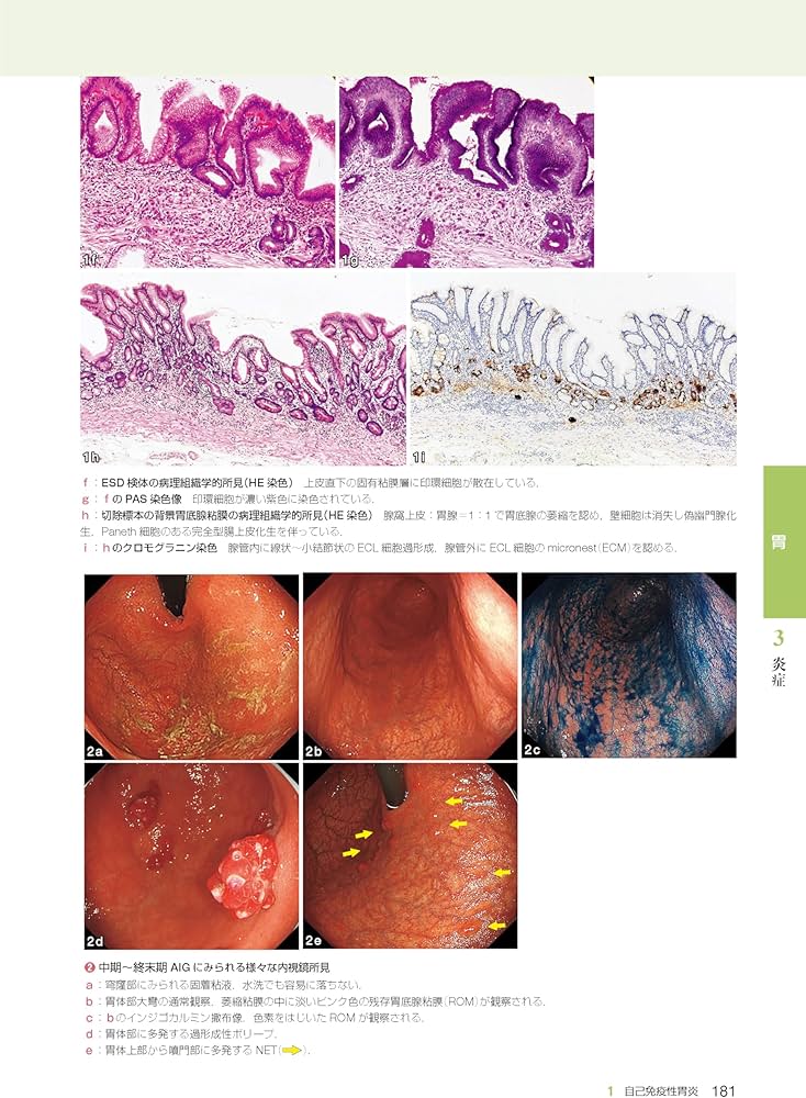 胃と腸アトラスI 上部消化管 第3版 | 「胃と腸」編集委員会, 蔵原 晃一