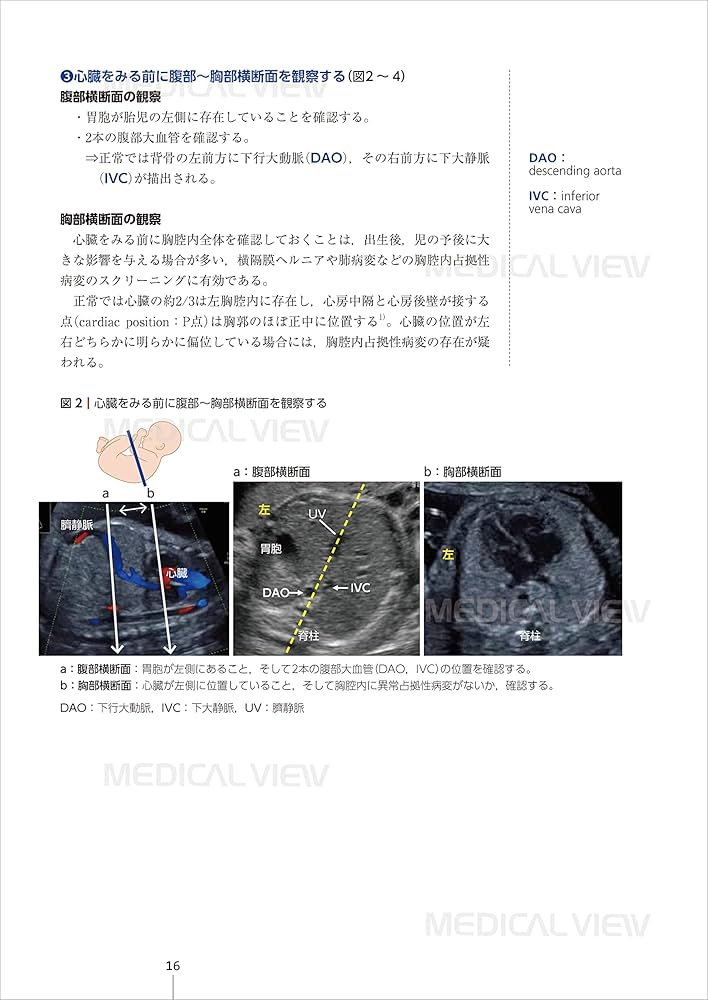 胎児心エコーのすべて−スクリーニング・精査・治療・そして家族支援