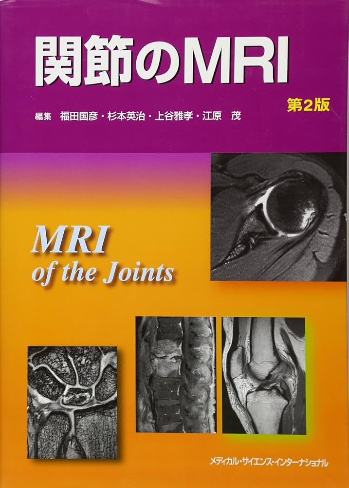 関節のMRI 第2版 | 福田国彦, 上谷雅孝, 杉本英治, 江原 茂 |本 | 通販