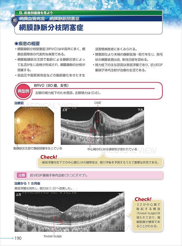 新OCT・OCTA読影トレーニング | 白神 史雄, 飯田 知弘 |本 | 通販 | Amazon