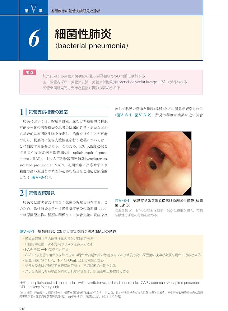気管支鏡テキスト 第3版 | 日本呼吸器内視鏡学会 |本 | 通販 | Amazon