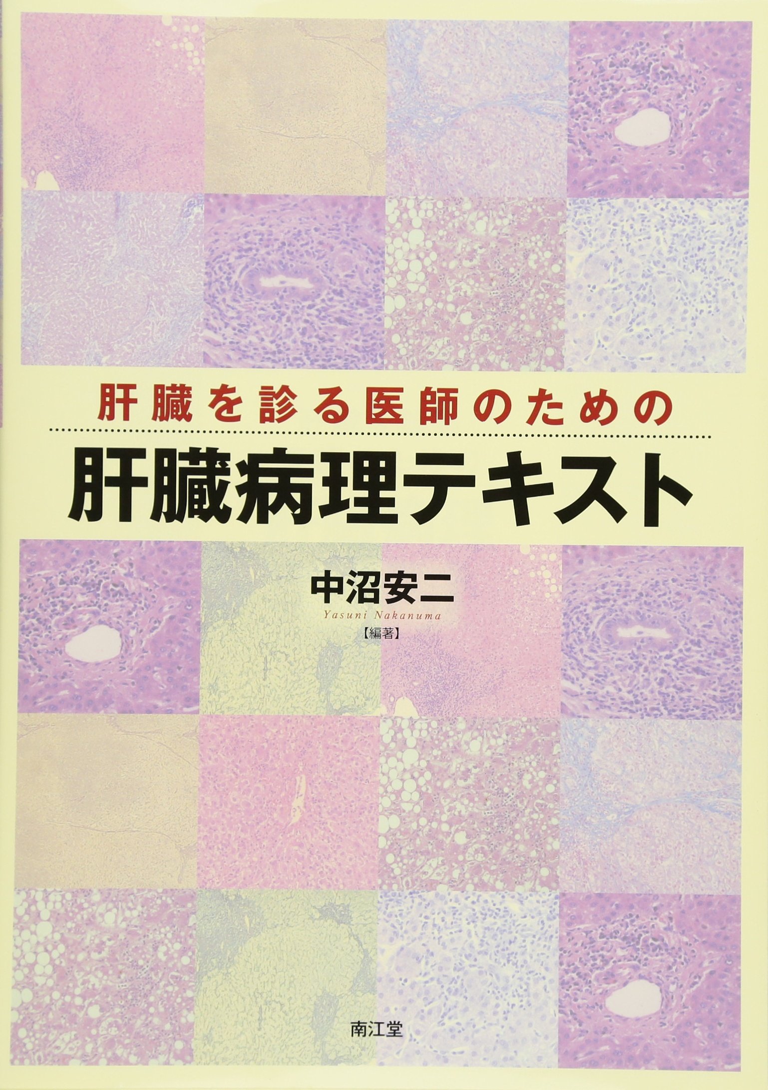 Amazon.co.jp: 肝臓を診る医師のための肝臓病理テキスト : 中沼安二