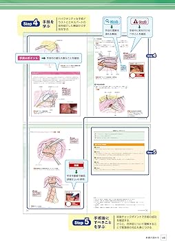 消化器腹腔鏡下手術 下部消化管 (ビジュアルサージカル) | 上西紀夫