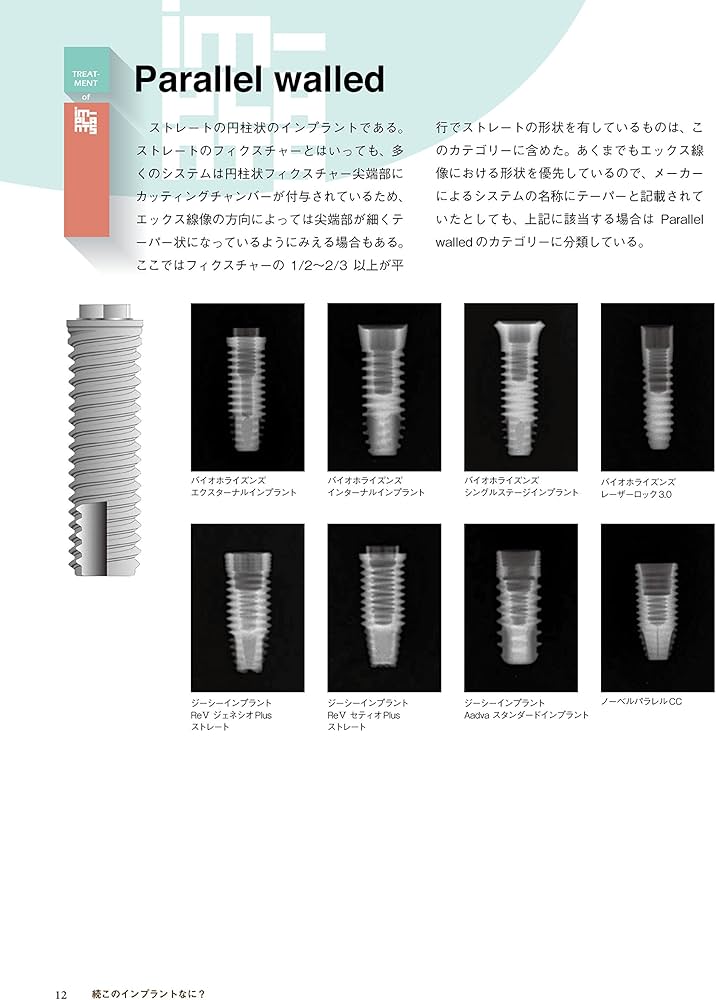 続・このインプラントなに? 他医院で治療されたインプラントへの対応