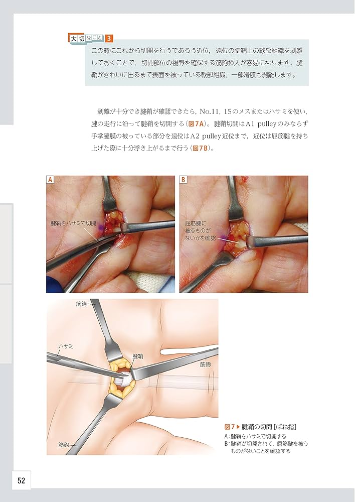 整形外科レジデントのためのベーシック手術 【上肢・脊椎・下肢 3冊合