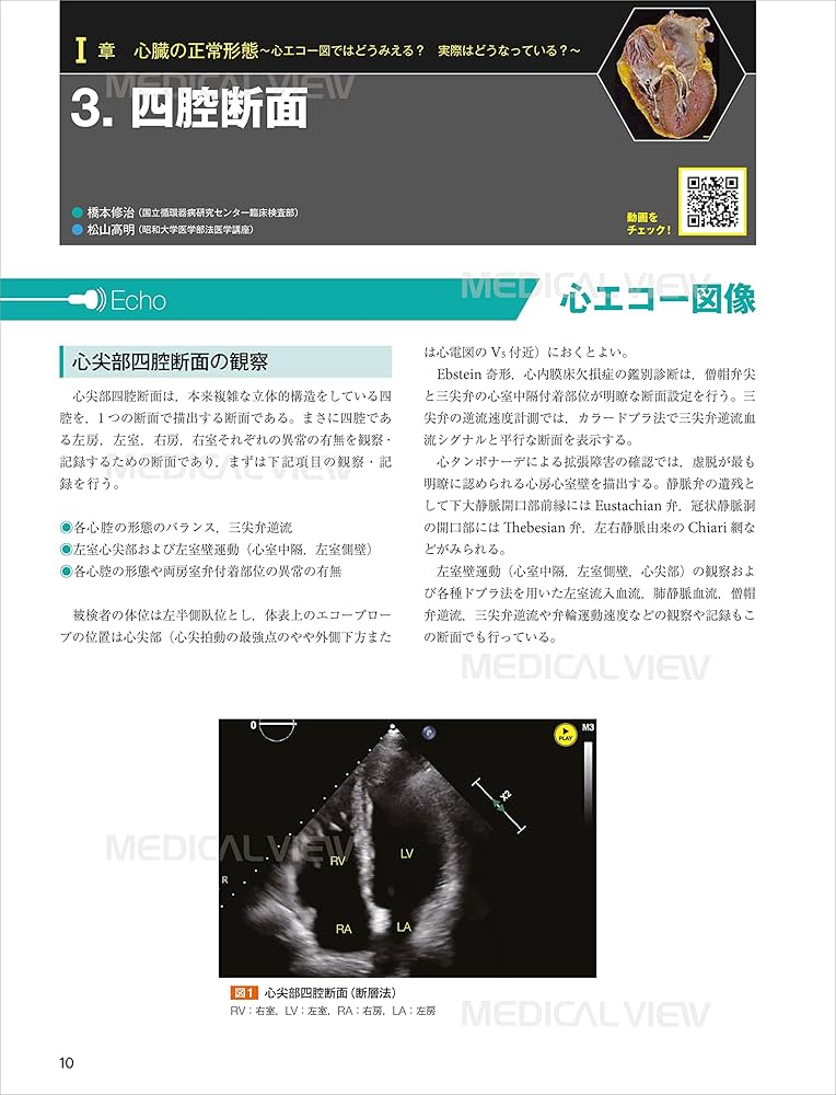 心エコー図検査に役立つ ヒト心臓形態のすべて | 植田 初江, 松山 高明