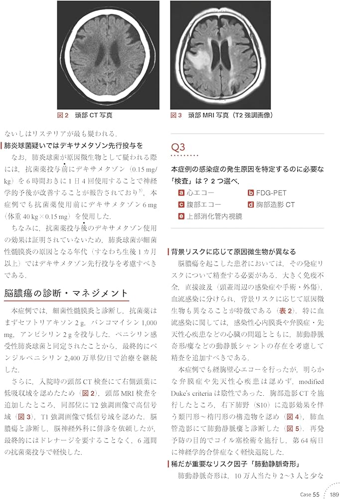 感染症内科ドリル WEB版付: みるトレ決定版 | 笠原 敬, 忽那 賢志