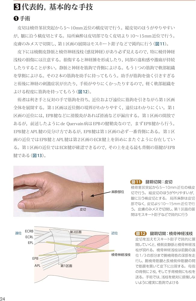 手外科手術ノート part3：外傷以外の主要疾患治療編 | 大井宏之 |本