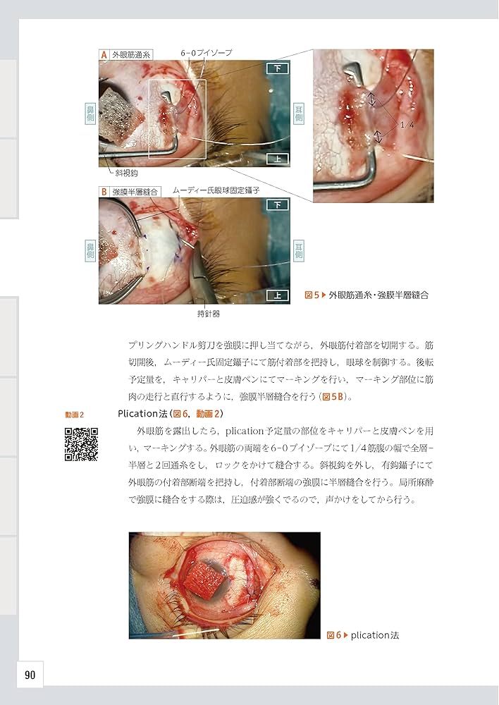 眼科レジデントのためのベーシック手術 ─ 電子版付 ─ | 谷戸正樹 |本