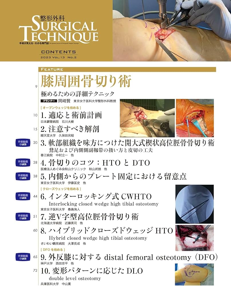 整形外科サージカルテクニック 2023年2号 膝周囲骨切り術（第13巻2号