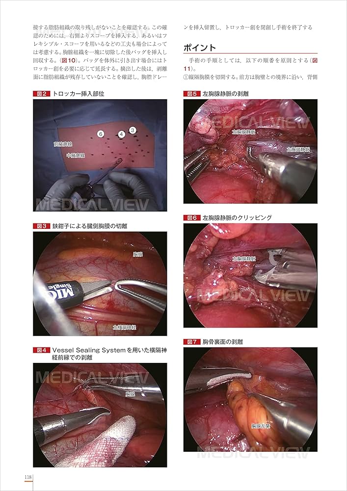 スタンダード小児内視鏡外科手術 | 田口 智章, 奥山 宏臣, 山髙 篤行