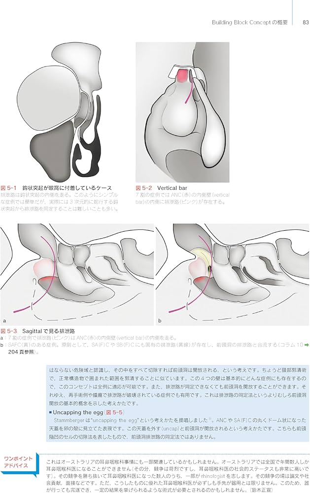 Amazon.co.jp: ウォーモルド直伝 内視鏡下鼻副鼻腔手術トレーニング