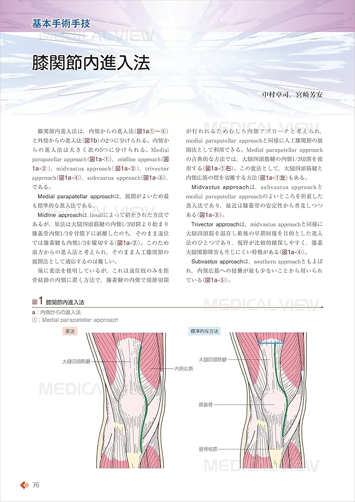 人工膝関節全置換術[TKA]のすべて−より安全に・より確実に | 勝呂 徹