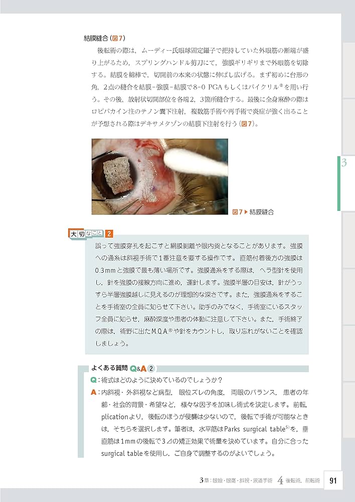 眼科レジデントのためのベーシック手術 ─ 電子版付 ─ | 谷戸正樹 |本