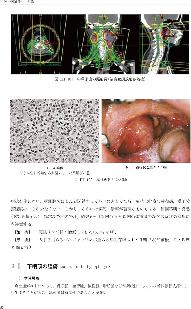 新耳鼻咽喉科学 | 野村 恭也, 加我 君孝, 切替 一郎 |本 | 通販 | Amazon