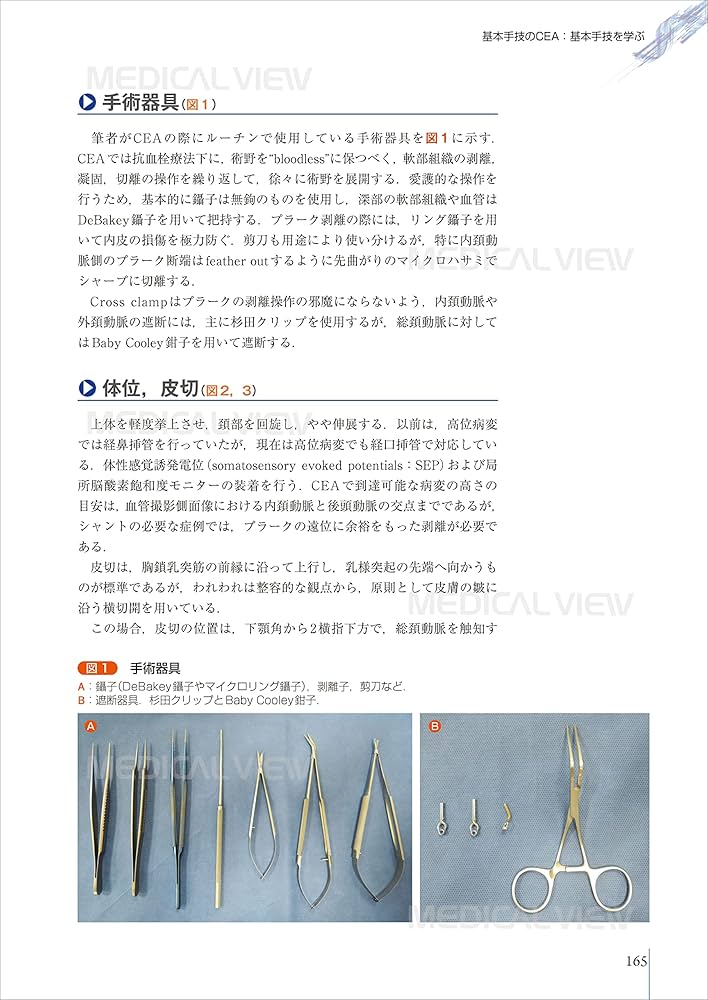 パーフェクトマスター 頚動脈狭窄症 | 永田 泉, 中原 一郎 |本 | 通販