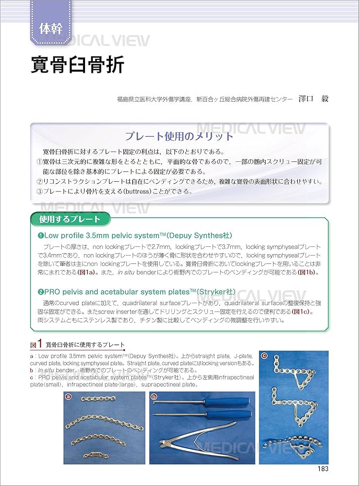 骨折 プレート治療マイスター−改訂第2版 | 澤口 毅 |本 | 通販 | Amazon