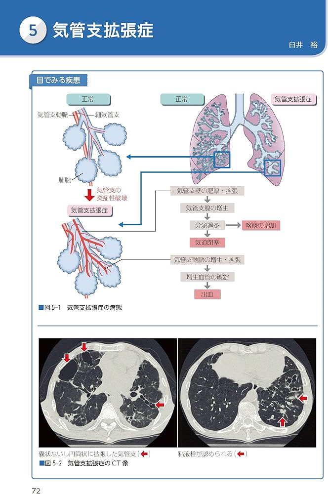 病期・病態・重症度からみた 疾患別看護過程 第4版: +病態関連図