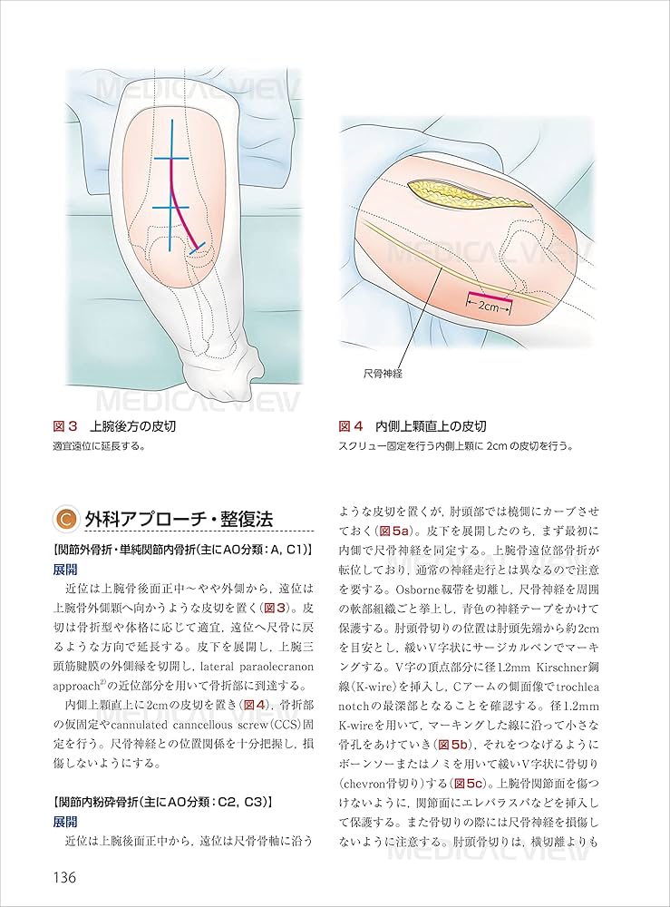 スタンダード骨折手術治療 上肢 | 渡部 欣忍 |本 | 通販 | Amazon
