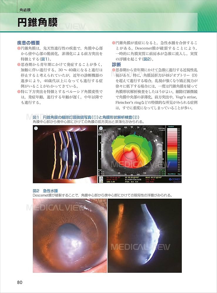 診断と治療 (眼科診療マイスター II) | 飯田 知弘, 中澤 徹, 堀 裕一