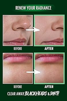 Amazon.com: [K-Beauty] Neogen Dermalogy Pore Zero Peeling Mousse