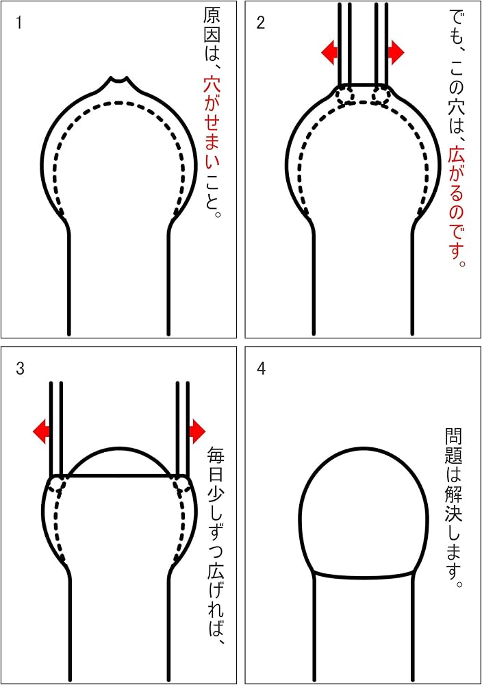 Amazon.co.jp: キトー君dx(メーカー直販) 真性専用。仮性の方は使え