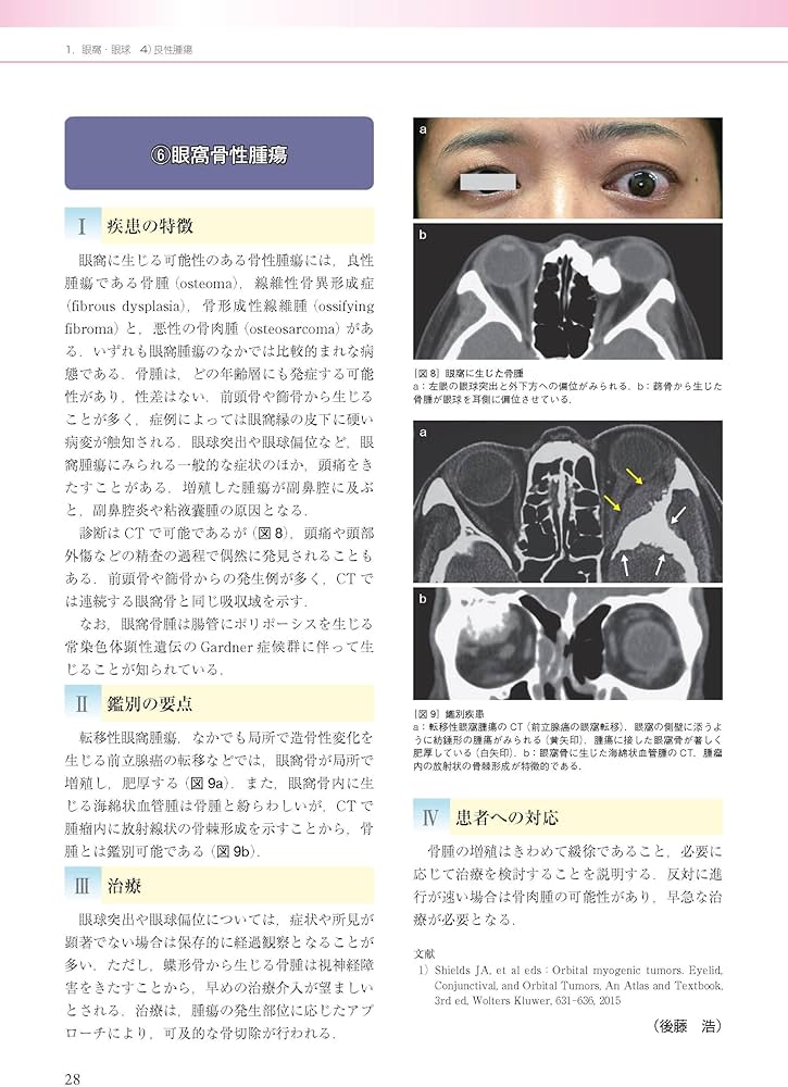 眼科診療ガイド 第2版 | 根木 昭 |本 | 通販 | Amazon