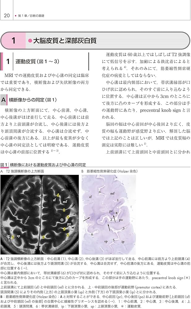 神経内科疾患の画像診断 第2版 | 柳下 章 |本 | 通販 | Amazon