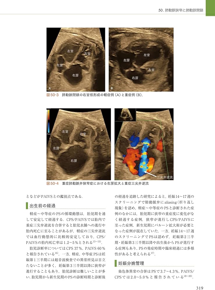 周産期マニュアル: 胎児疾患の診断から管理まで | 佐村 修, 宗田 聡