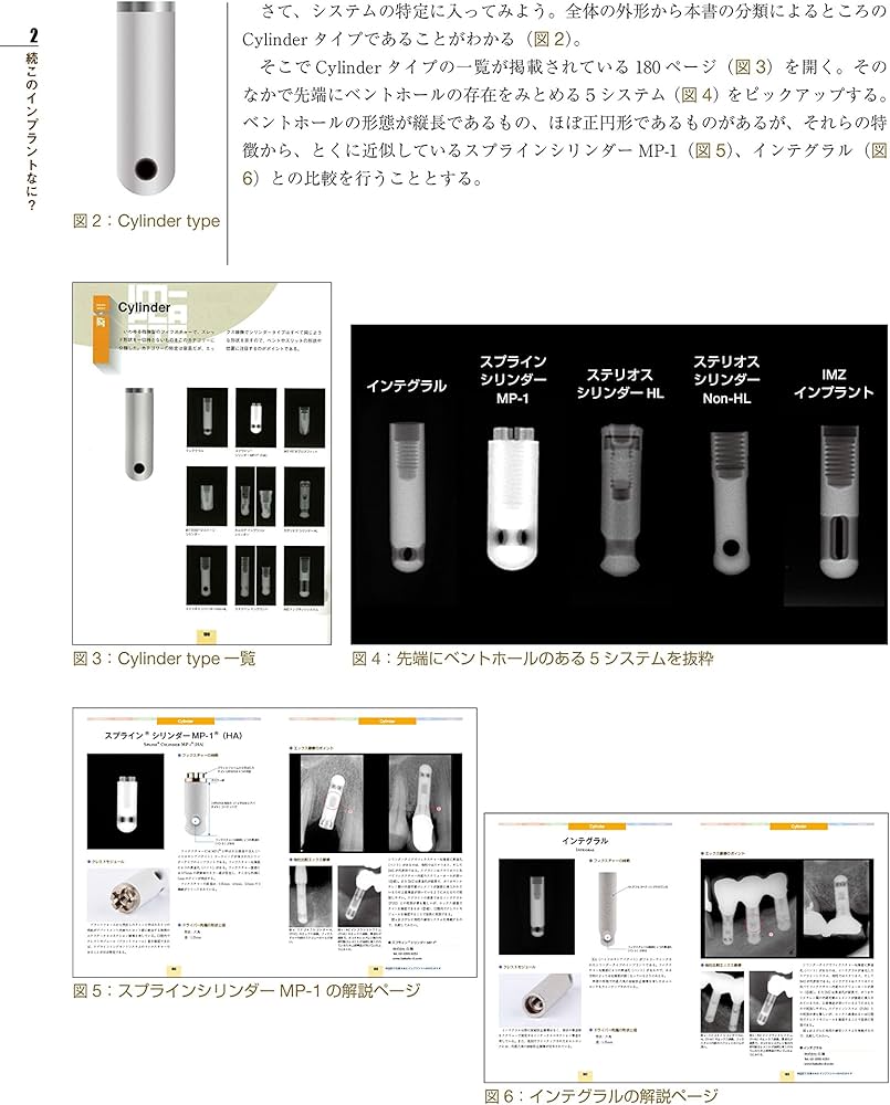 続・このインプラントなに? 他医院で治療されたインプラントへの対応