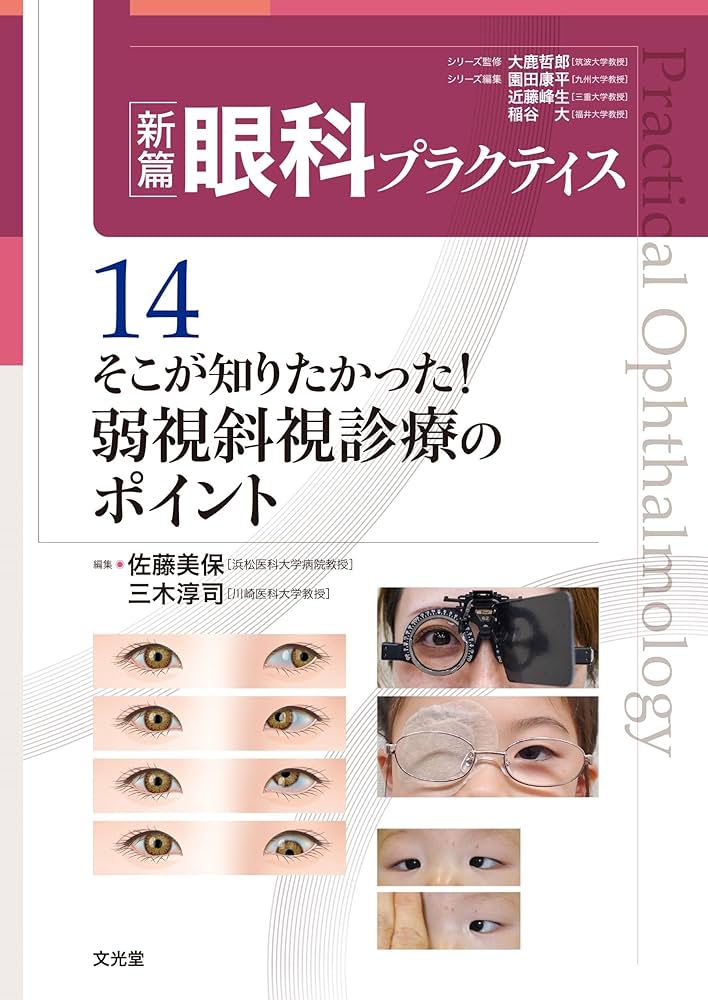 そこが知りたかった!弱視斜視診療のポイント (新篇眼科プラクティス 14