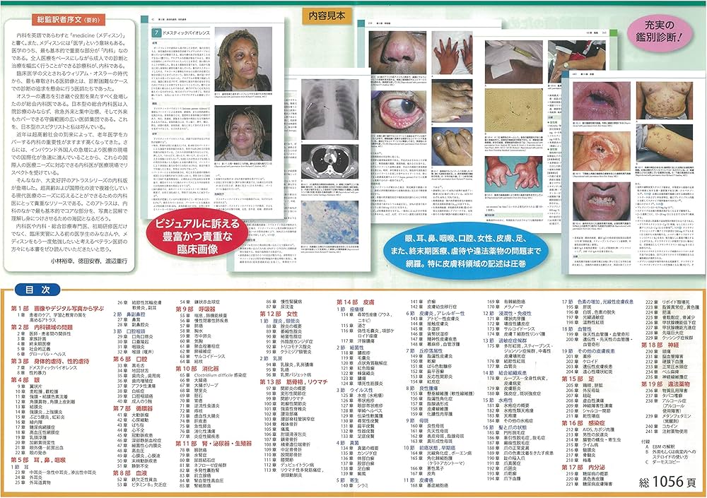 カラー版 国際診療のための内科アトラス大事典 | リチャード・P・ユー