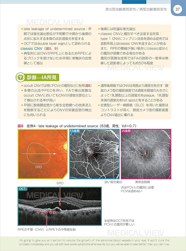 網膜診療クローズアップ 改訂第2版 | 柳 靖雄 |本 | 通販 | Amazon