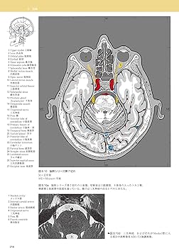 脳の機能解剖と画像診断 第2版 | 眞柳 佳昭 |本 | 通販 | Amazon