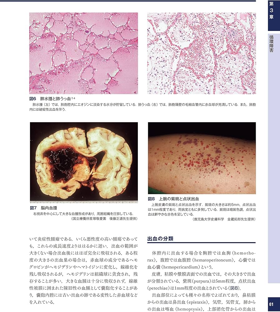 解明 病理学 第3版 病気のメカニズムを解く | 青笹克之, 加藤光保