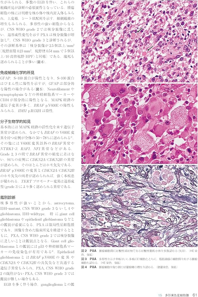 Amazon.co.jp: 脳腫瘍臨床病理カラーアトラス 第5版 : 日本脳腫瘍病理
