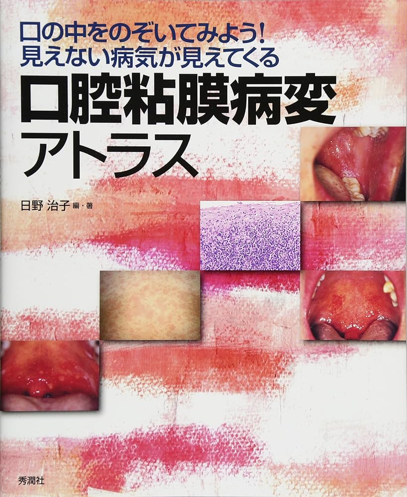 Amazon.co.jp: 口腔粘膜病変アトラス: 口の中をのぞいてみよう!見え