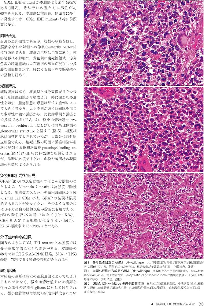 Amazon.co.jp: 脳腫瘍臨床病理カラーアトラス 第4版 : 日本脳腫瘍病理