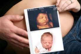 Amazon.co.jp: SONY UPC-21L Lサイズカラープリントパック : 産業